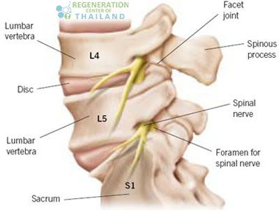 treat-sciatic-nerve-Injury-thailand1